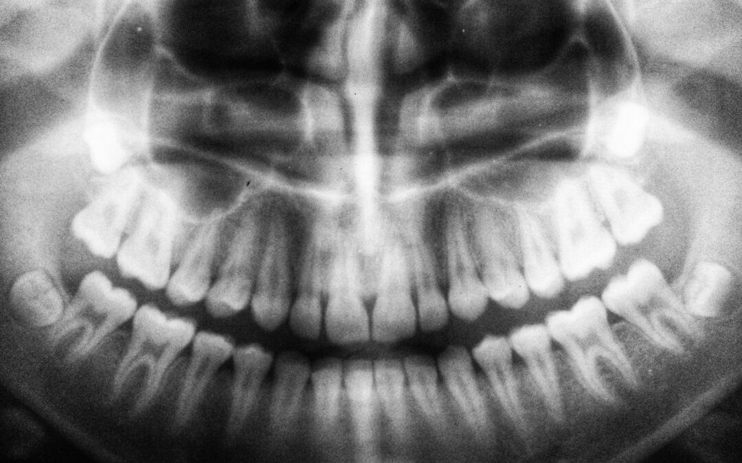 Dental Reconstruction