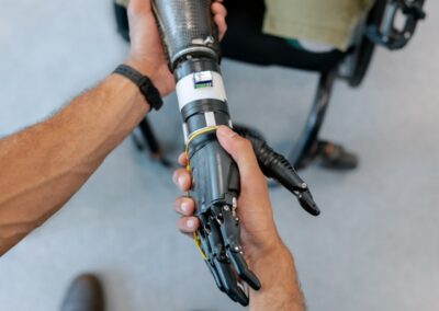 Affordable Advanced Prosthetic Solutions